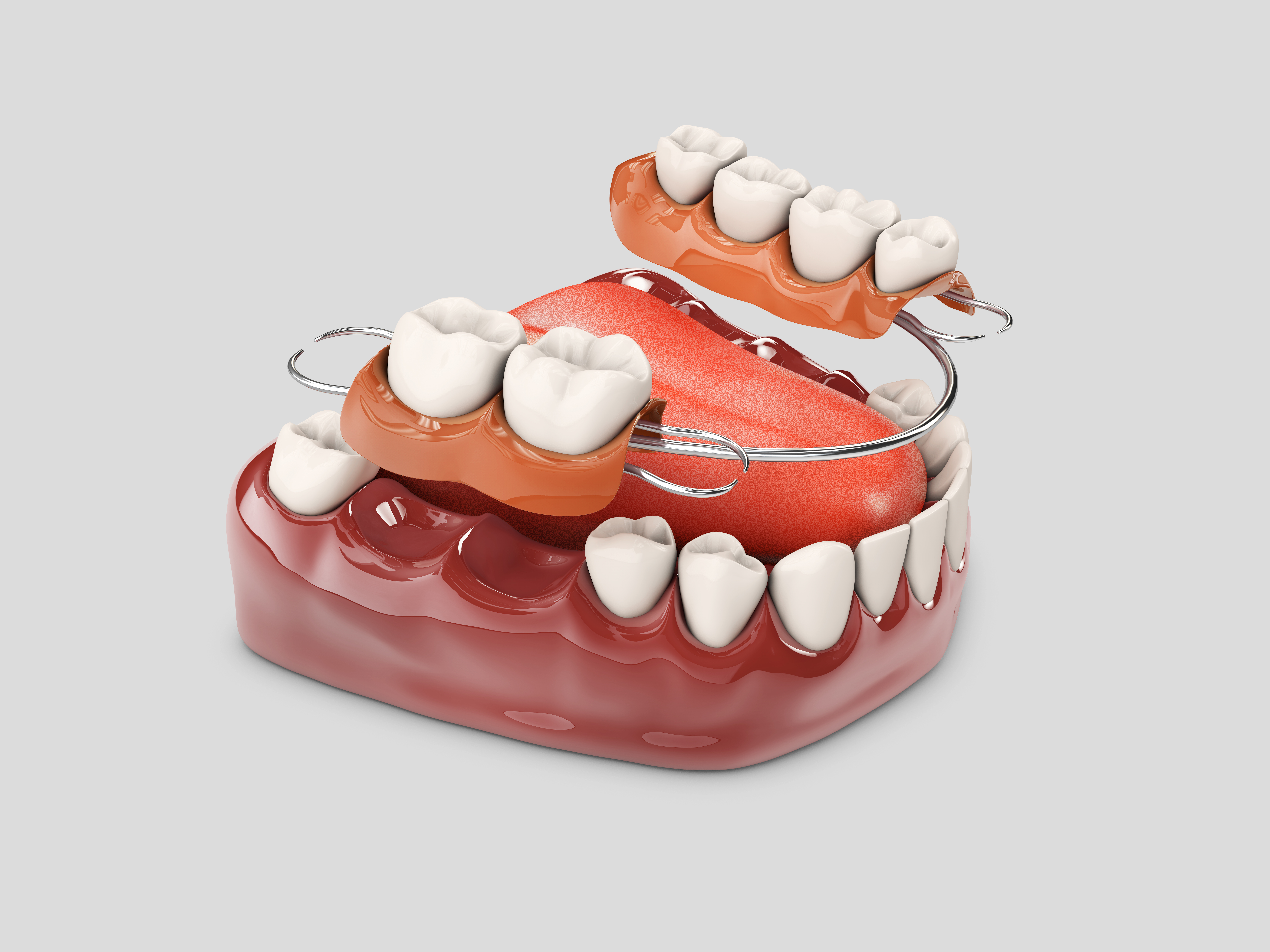 Протезирование зубов — доступно и качественно!