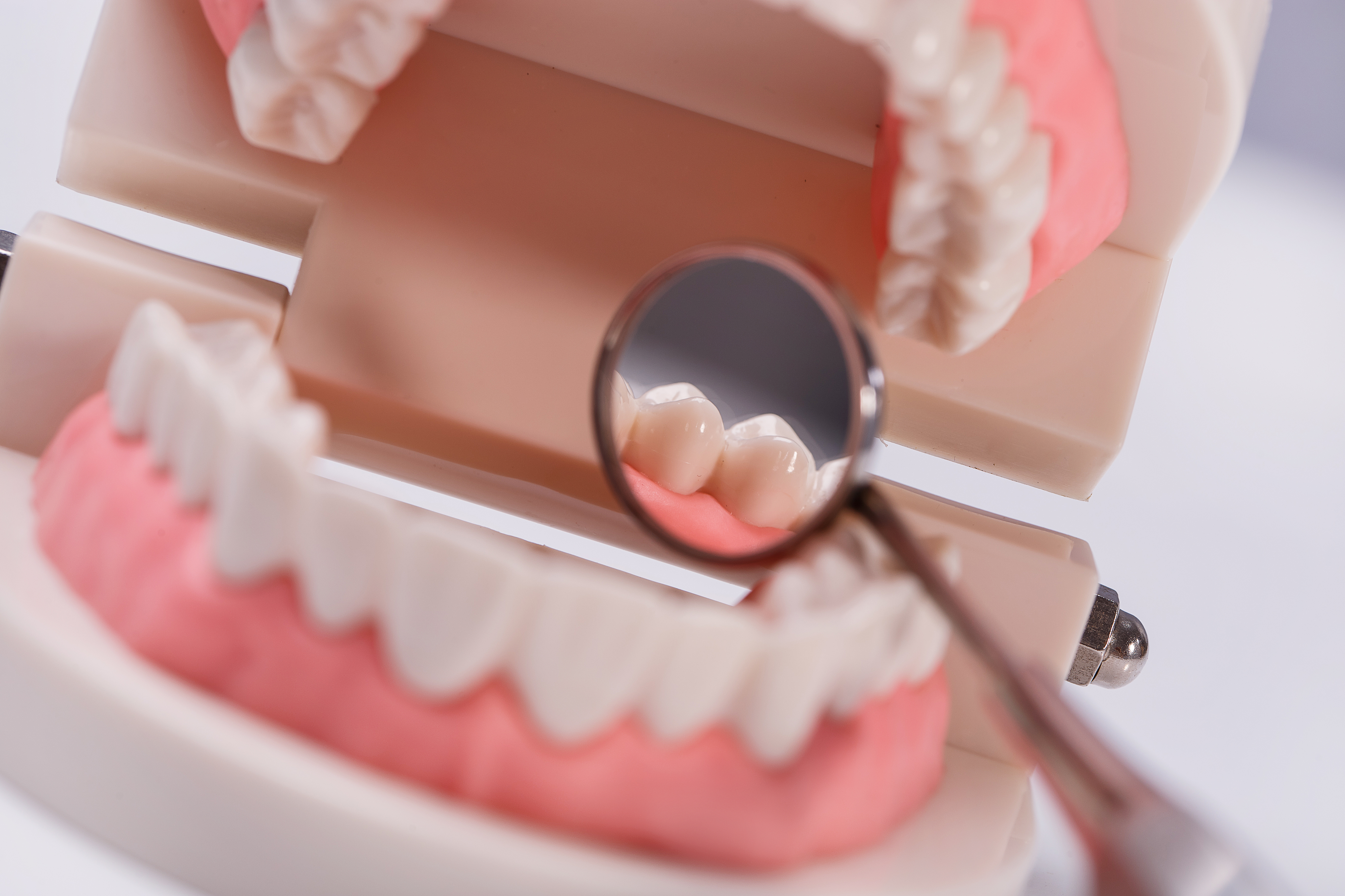 Протезирование зубов — доступно и качественно!