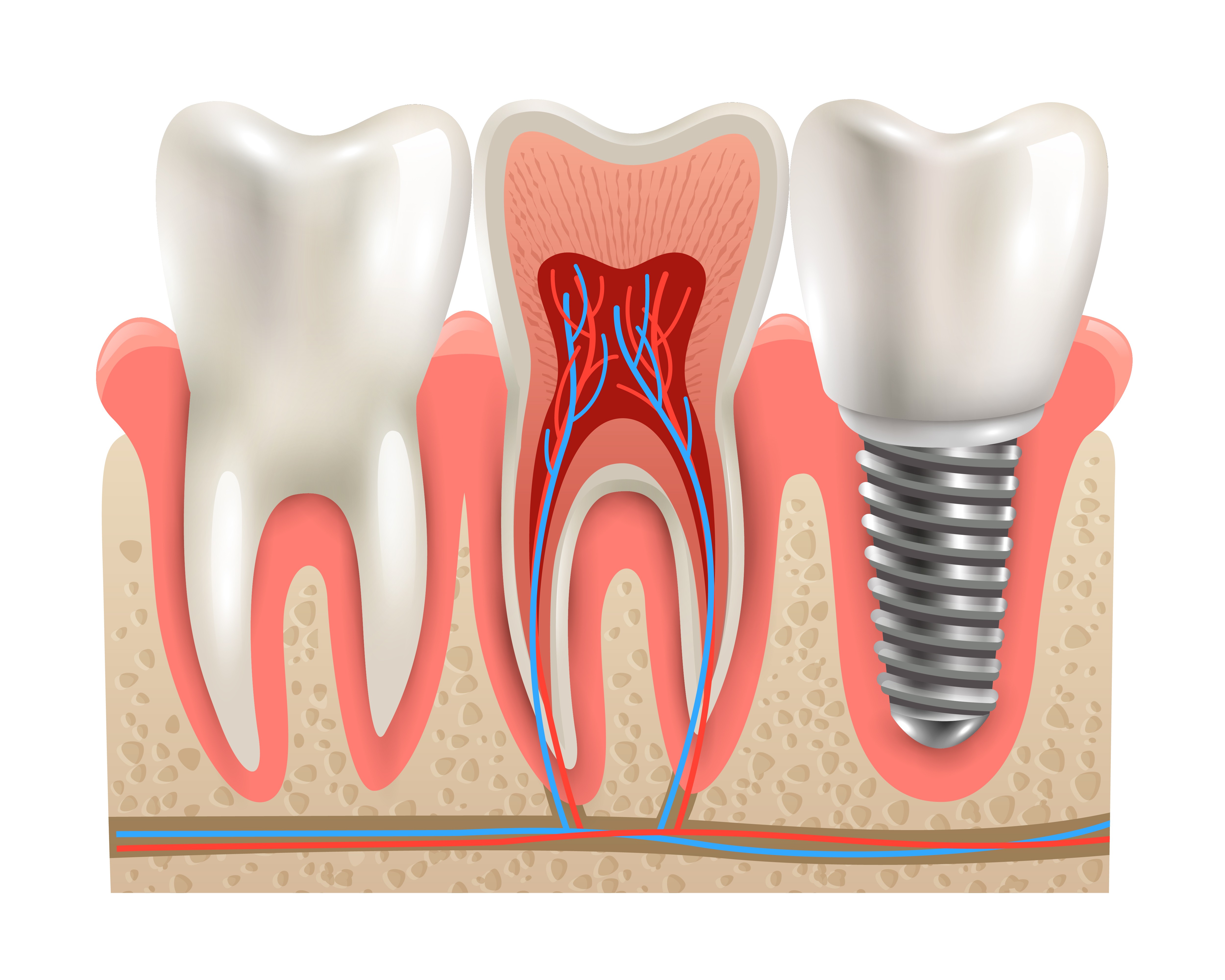 Отсутствие зубов — первичная и вторичная адентия