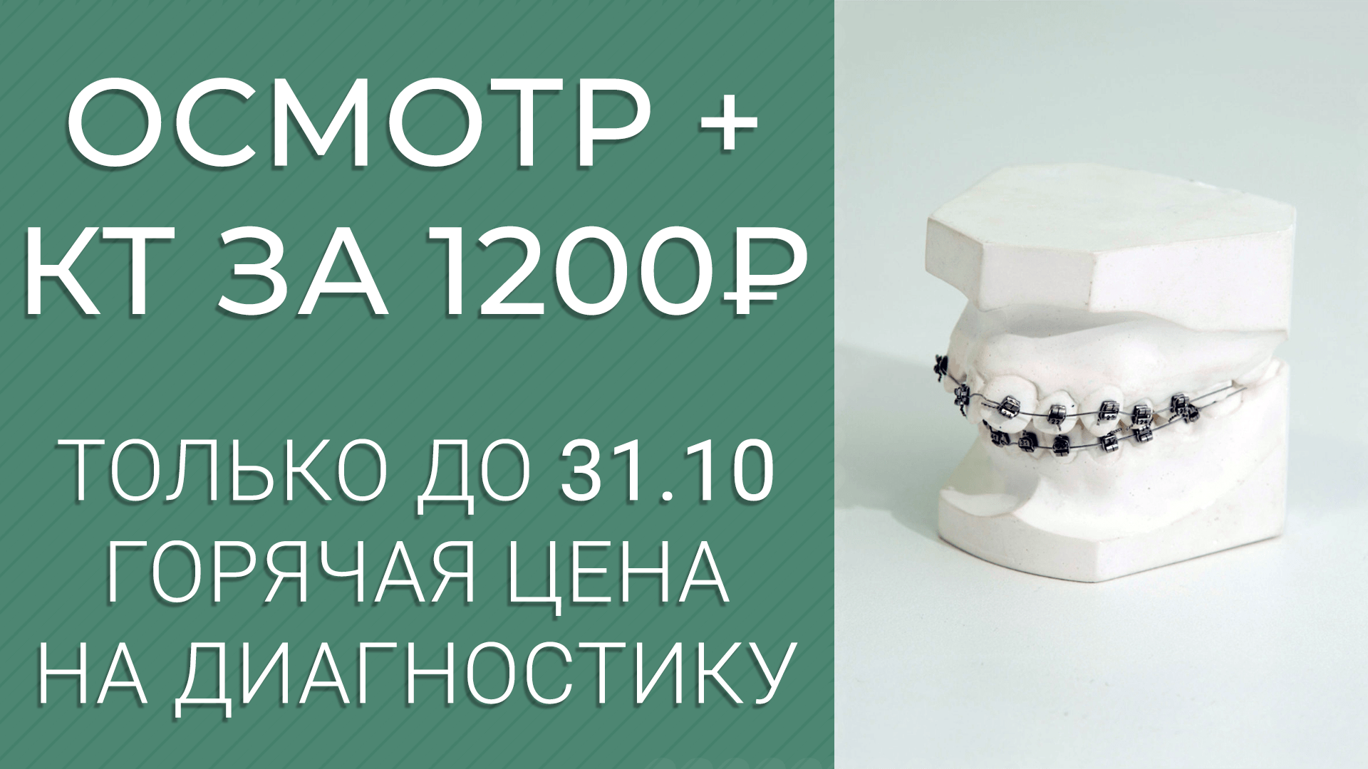 Консультация ортодонта + КТ-диагностика – 1200 руб!