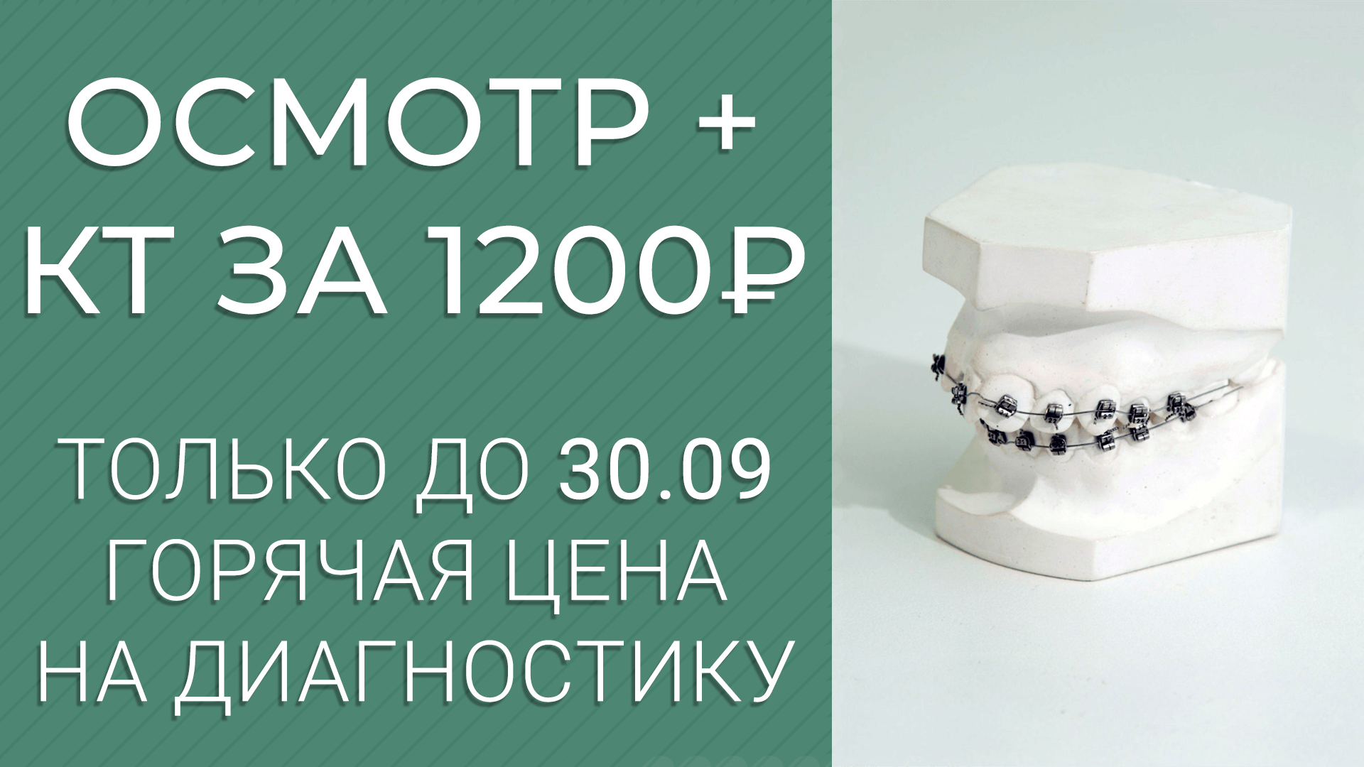 Консультация ортодонта + КТ-диагностика – 1200 руб!