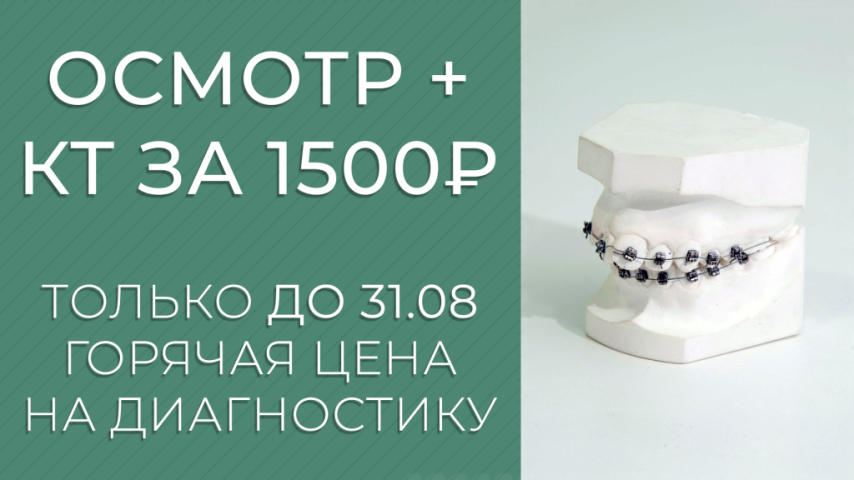 Консультация ортодонта + КТ-диагностика – 1500 руб! Консультация ортодонта + КТ-диагностика – 1500 руб!