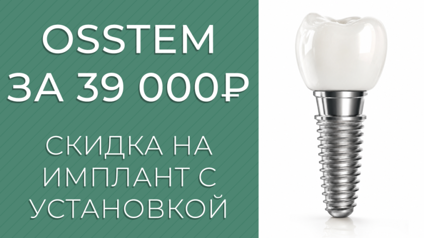 Имплант Osstem с установкой — 39 000 руб. Имплант Osstem с установкой — 39 000 руб.