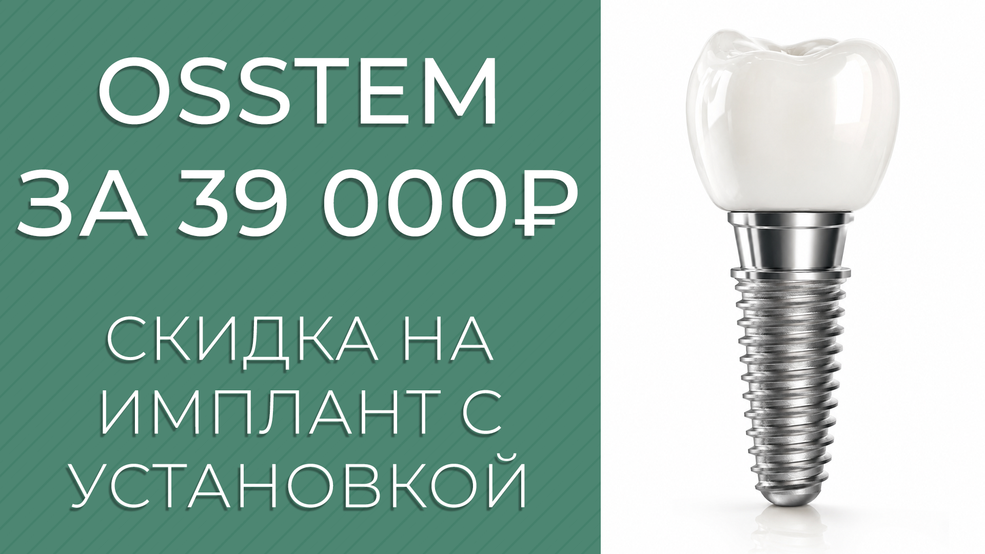 Имплант Osstem с установкой — 39 000 руб. Имплант Osstem с установкой — 39 000 руб.